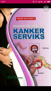 Image of Asuhan ibu dengan kanker serviks