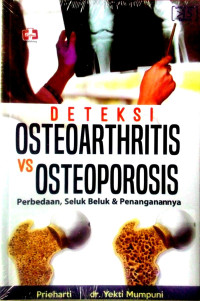 Image of Deteksi osteoarthritis vs osteoporosis : perbedaan, seluk beluk & penanganannya
