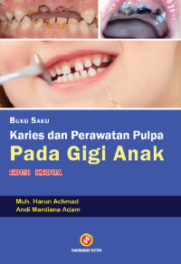 Image of Buku saku karies dan perawatan pulpa pada gigi anak edisi 2
