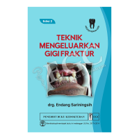 Image of Teknik mengeluarkan gigi fraktur