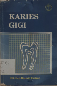 Image of Karies gigi